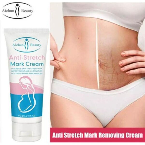 Anti Stretch Mark Cream-60 gm - Image 2